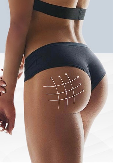 Brazilian butt lift curves, rear view